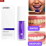 Kit para Sonrisas, Blanqueamiento dental